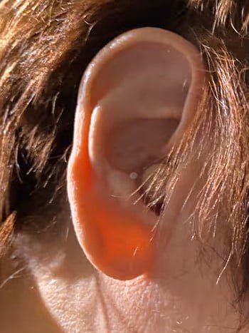 Audien Hearing Aids 6